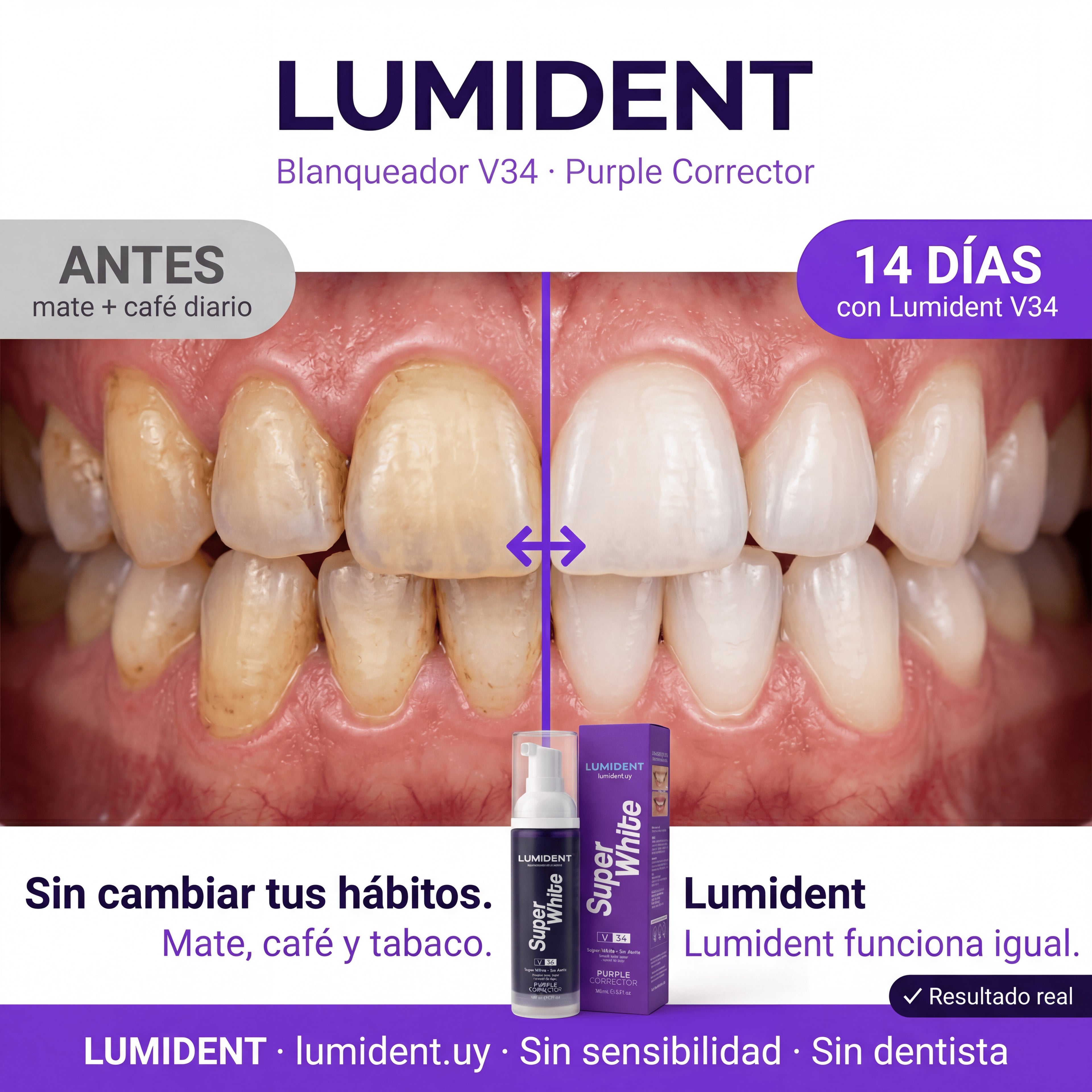 Lumident™ Blanqueador Dental V34 + Regalo