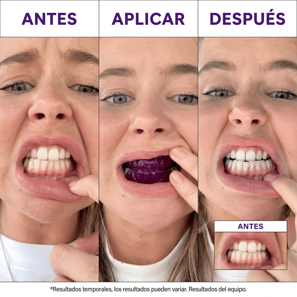 Lumident™ Tiras Blanqueadoras V34