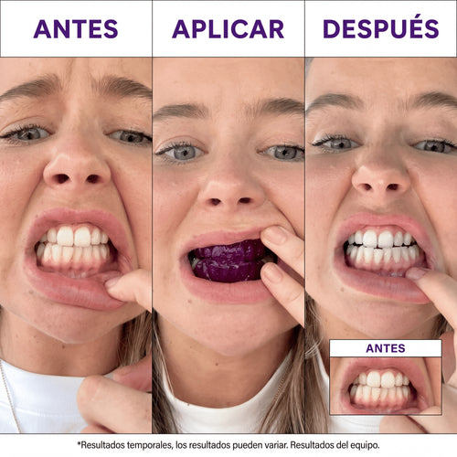 Lumident™ Tiras Blanqueadoras V34