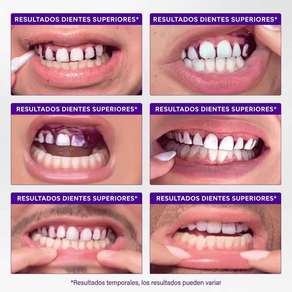 Lumident™ Tiras Blanqueadoras V34